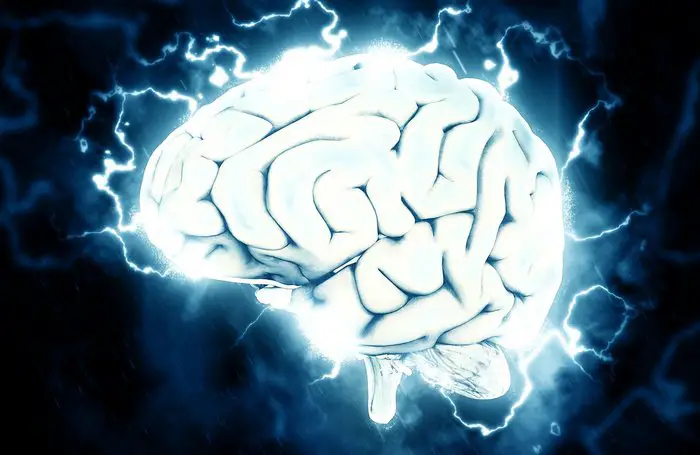 Chronic migraine brain graphic